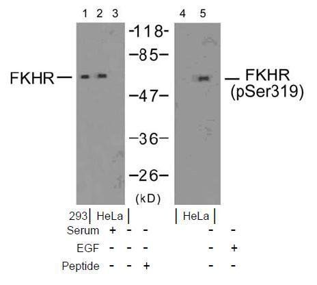 FKHR (Phospho-Ser319) Antibody