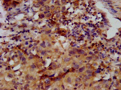 FKRP Antibody