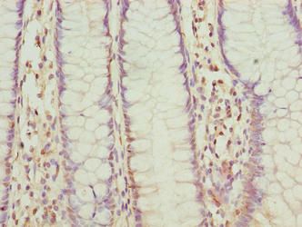 FLAD1 Antibody