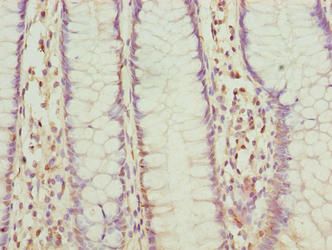 FLAD1 antibody