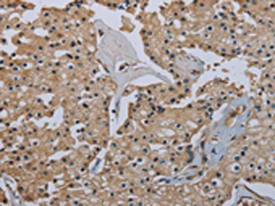 FLCN Antibody