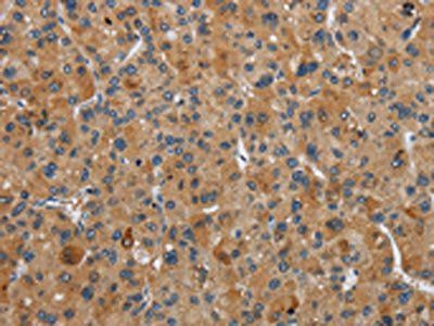 FLCN Antibody