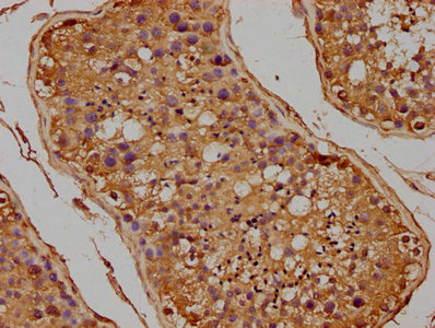 FLCN Antibody