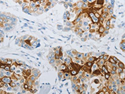FLG Antibody