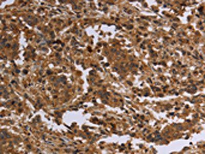 FLG Antibody