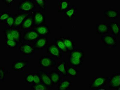 FLI1 Antibody