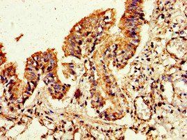 FLI1 Antibody