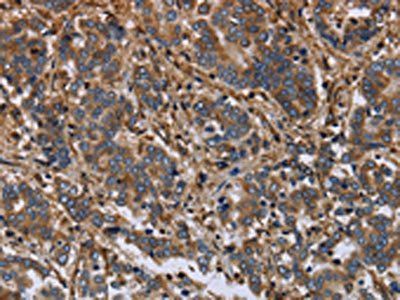 FLNA Antibody