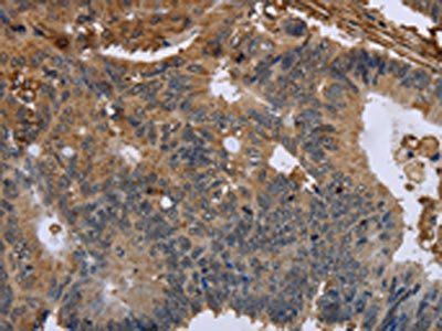 FLNA Antibody