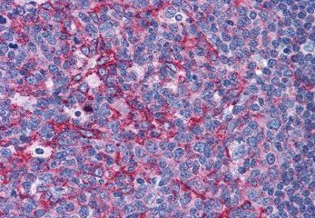 Goat anti-Flotillin 2 / FLOT2 (C Term) Antibody