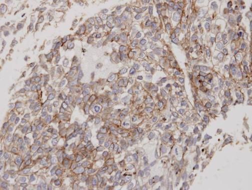 Flotillin 2 antibody [C3], C-term