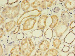 FLRT1 Antibody