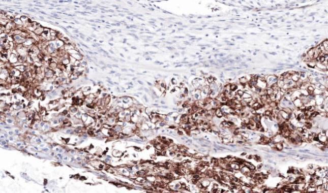 FLRT1 antibody [N1N3]
