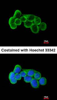 FLRT1 antibody