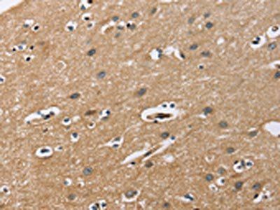FLT3 Antibody