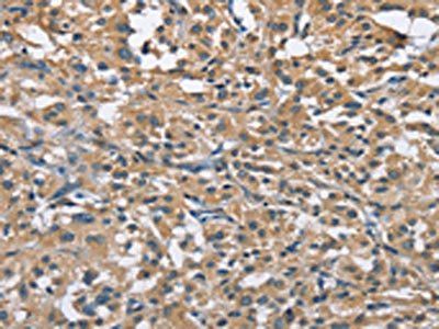 FLT3 antibody