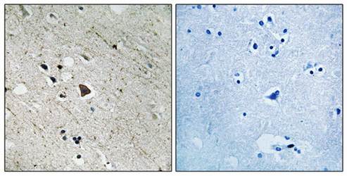 FLT3 (phospho-Tyr969) antibody