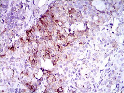 FLT3 Antibody