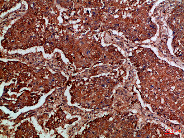 FLT4 Antibody