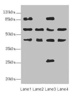 FLVCR2 Antibody