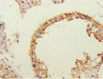 FLVCR2 Antibody