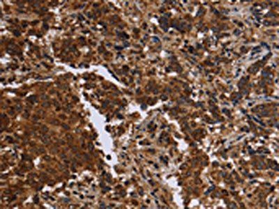 FMN2 Antibody
