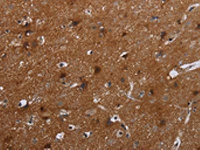 FMN2 Antibody