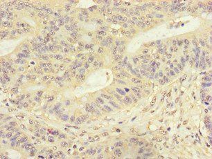 FMNL3 Antibody