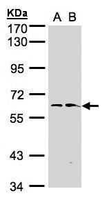 FMO1 Rabbit Polyclonal Antibody
