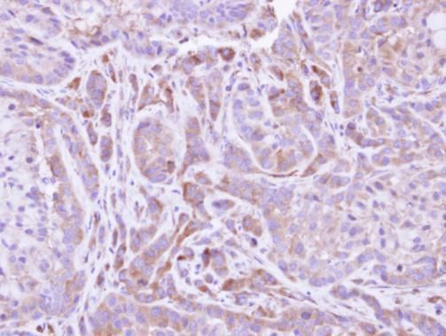 flavin containing monooxygenase 2 Antibody