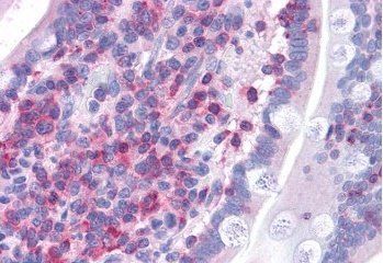 FBP17/FNBP1 Antibody