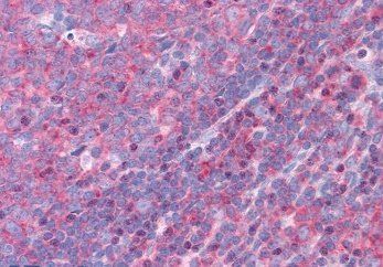 FBP17/FNBP1 Antibody