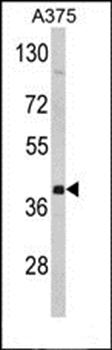 FNTA antibody