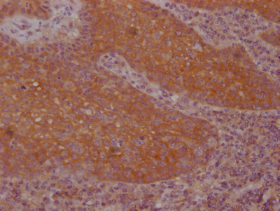 FNTB Recombinant Monoclonal Antibody