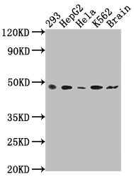 FNTB Recombinant Monoclonal Antibody