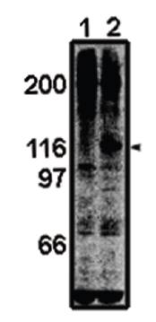 Rabbit anti Mouse Focal Adhesion Kinase (FAK) Antibody