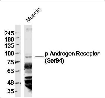Folate Receptor 4 antibody