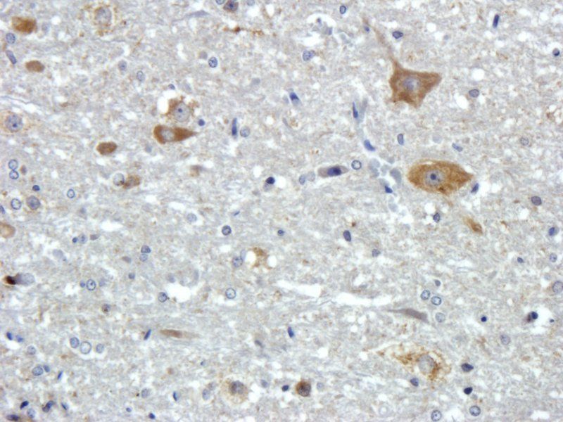 FOLR2 antibody