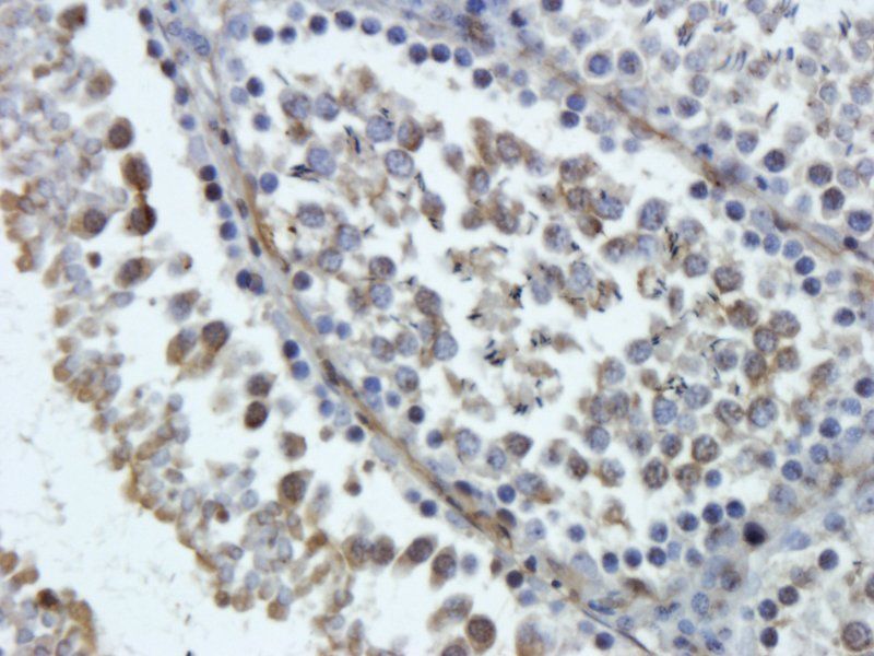 FOLR2 antibody