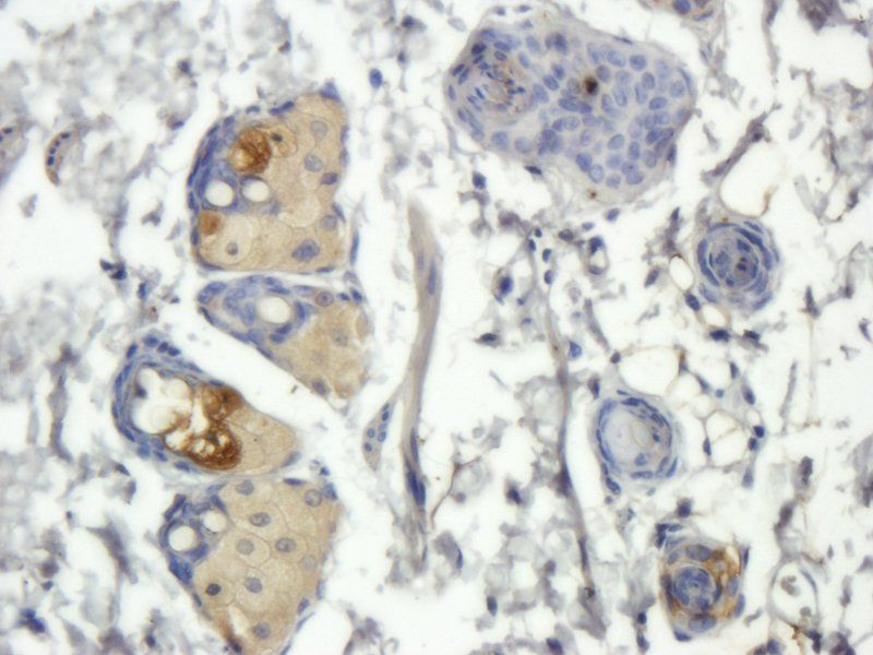 FOLR2 antibody