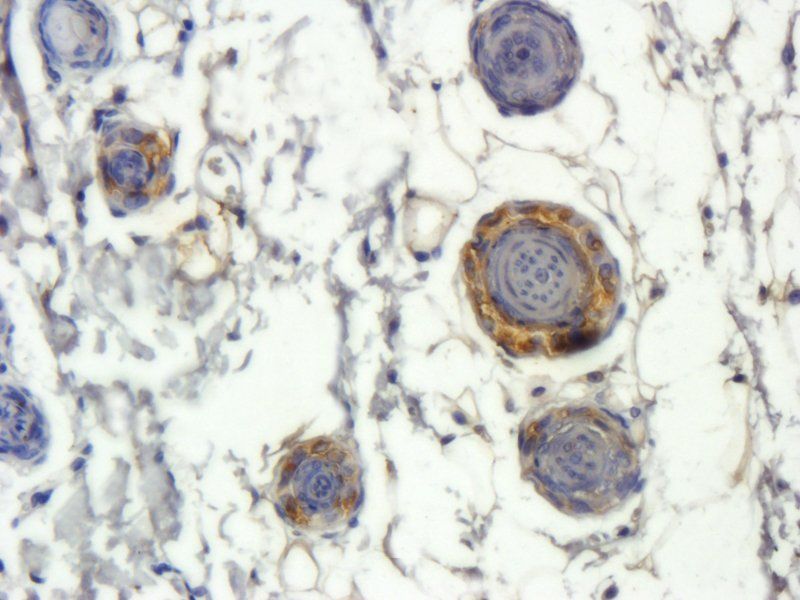 FOLR2 antibody