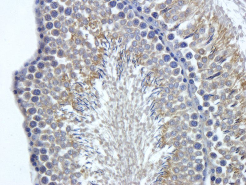 FOLR2 antibody