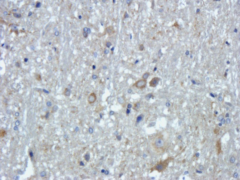 FOLR2 antibody