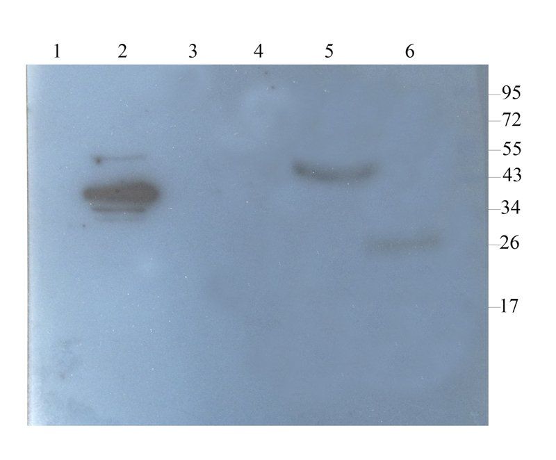 FOLR2 antibody