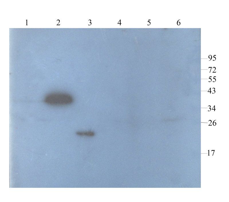 FOLR2 antibody