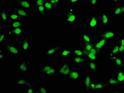 Forkhead box protein P1 antibody