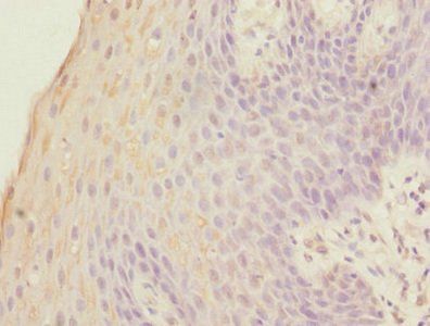 FOXP1 Antibody