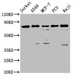 Forkhead box protein P1 antibody