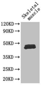 Forkhead box protein P3 antibody