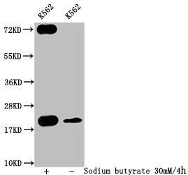 HIST1H1C Antibody
